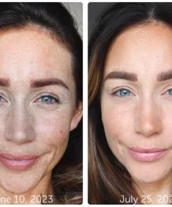 GFOUK™ Vline EMS 360 Wand