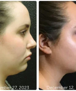 GFOUK™ Vline EMS 360 Wand