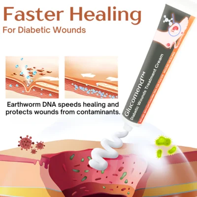 Glucomend™ Diabetic Wounds Treatment CreamGlucomend™ Diabetic Wounds Treatment Cream