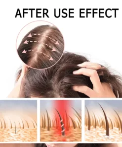 HZA™ Natural Hair Growth Oil