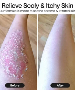 HerbalGrace Pure Pine Tar Bath Soap