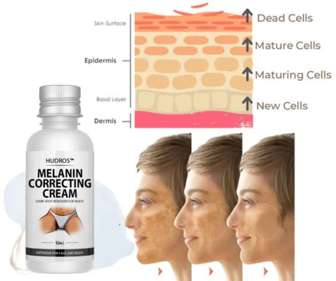 Hudros® Acanthosis Nigricans Therapy