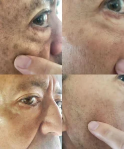 Hudros® Melanin Correcting Serum