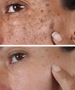 Hudros® Melanin Correcting Serum