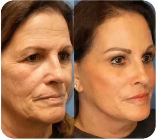 Instant face Tightener No-Filter Prime