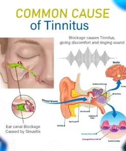 JEREMYTIS ™ Goldenseal Nasal Spray