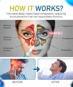 JEREMYTIS ™ Goldenseal Nasal Spray