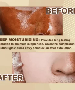 JEREMYTIS™ Natural Cleansing Black Tea Exfoliating Mask