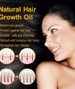 JEREMYTIS™ Natural Hair Growth Oil