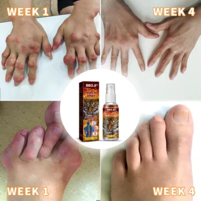 Joint And Bone Theraty BBOJI™ Tigers Oil Spray