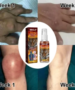 Joint And Bone Theraty BBOJI™ Tigers Oil Spray