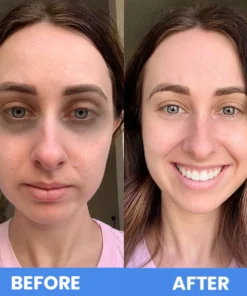 LIMETOW™ Micro-Needle Eye Patch