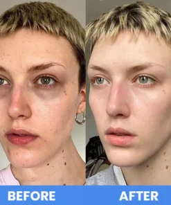 LIMETOW™ Micro-Needle Eye Patch