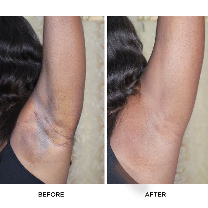 LIMETOW™ Turmeric Dark Spot Fading Scrub - Image 3