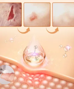 LOVILDS™Diabetic Wound Treatment Cream