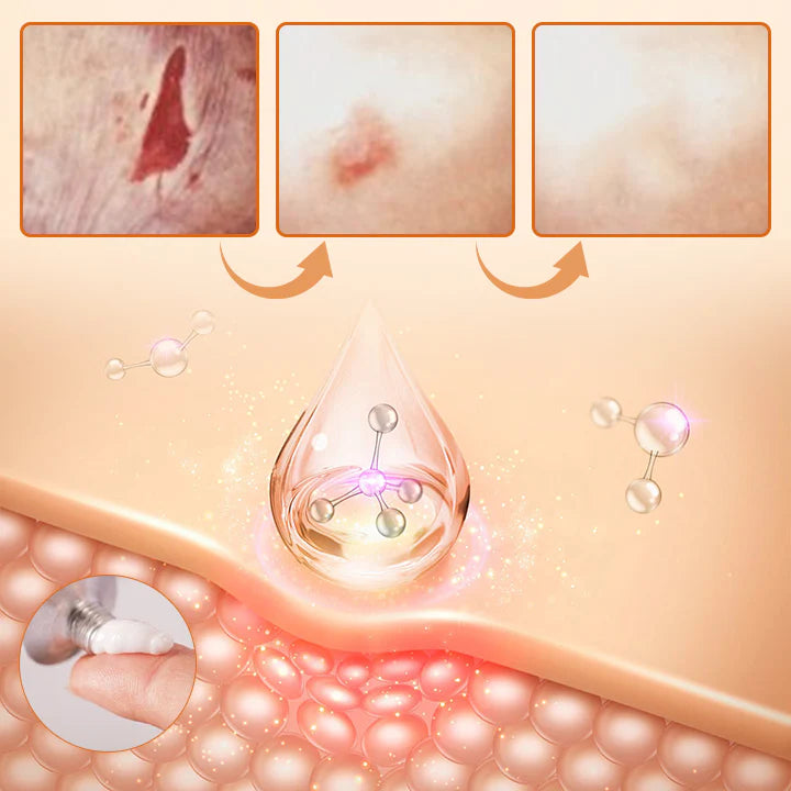 LOVILDS™Diabetic Wound Treatment Cream