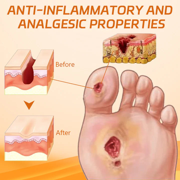 LOVILDS™Diabetic Wound Treatment Cream