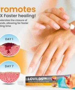 LOVILDS™Diabetic Wound Treatment Cream