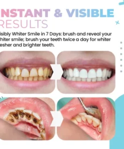 LOVILDS™Teeth Whitening Powder