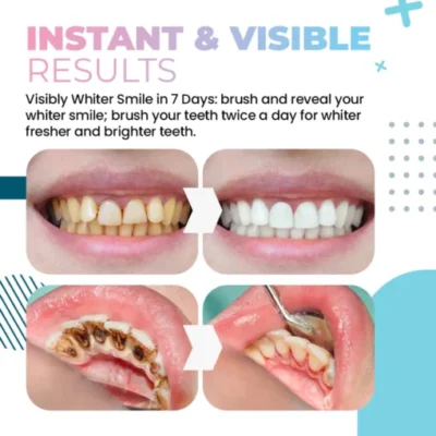 LOVILDS™Teeth Whitening Powder