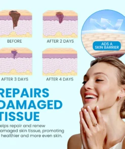 LanClare™ Triple-Active Brightening Dark Spot Corrector Remover