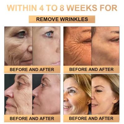 Lotmay™ Super Anti-Aging Cream