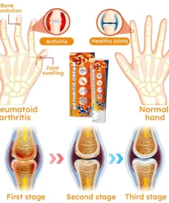 Lotmay™ Turmeric Arthritis Cream