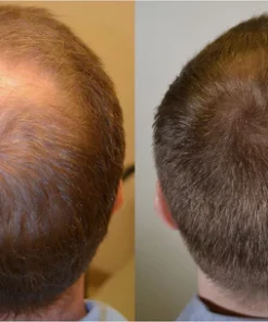 Lovilds™ Rapid Hair Growth Serum