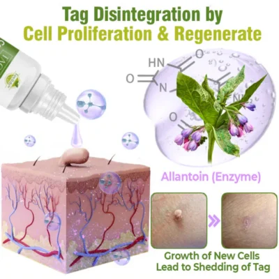 Lovilds™ TagOff Comfrey Herbal Treatment Serum