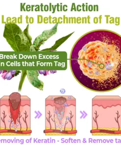 Lovilds™ TagOff Comfrey Herbal Treatment Serum