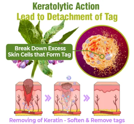 Lovilds™ TagOff Comfrey Herbal Treatment Serum