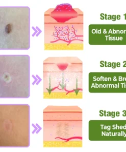 Lovilds™ TagOff Comfrey Herbal Treatment Serum