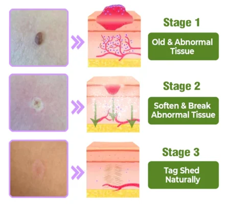 Lovilds™ TagOff Comfrey Herbal Treatment Serum