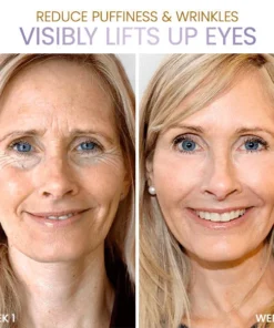 MediEye Anti Wrinkle Complex Eye Cream