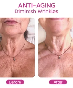 NECKPON™ Hydrolized Collagen Neck Cream