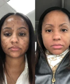 NESLEMY™ Turmeric Spot Repair Serum