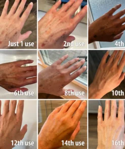 NESLEMY™ Turmeric Spot Repair Serum