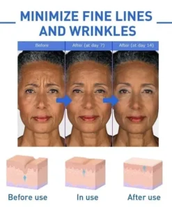 NESLEMY™botulinum Face Serum