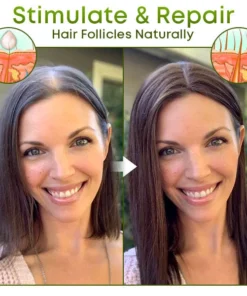 Nat'grow Hair Anti-Loss Herbal Serum