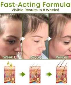 Nat'grow Hair Anti-Loss Herbal Serum