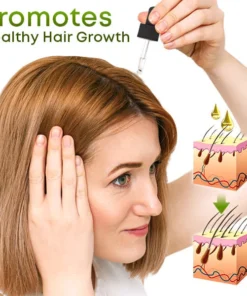 Nat'grow Hair Anti-Loss Herbal Serum