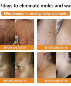 Negsuy™ Bienengift Mole & Warze Behandlung Creme