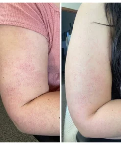 Negusy™ KeraTone Bee Venom Soap