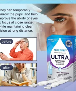 Nurbini™ Cataracts & Glaucoma Eye Drops