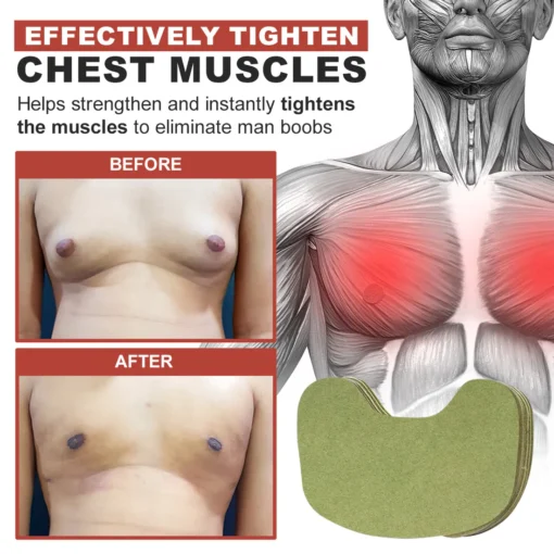 Nurbini™ Gynecomastia & Cellulite Reduction Patches