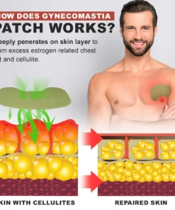 Nurbini™ Gynecomastia & Cellulite Reduction Patches