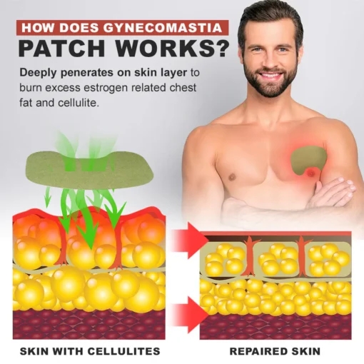 Nurbini™ Gynecomastia & Cellulite Reduction Patches