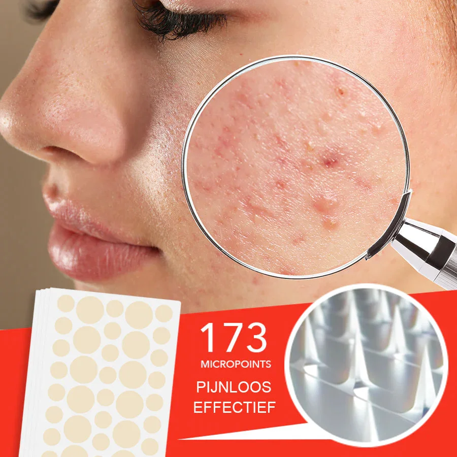 Nurbini™ Micro Darts Tagless Patch