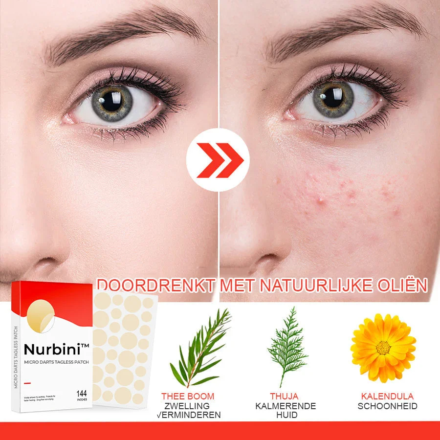 Nurbini™ Micro Darts Tagless Patch