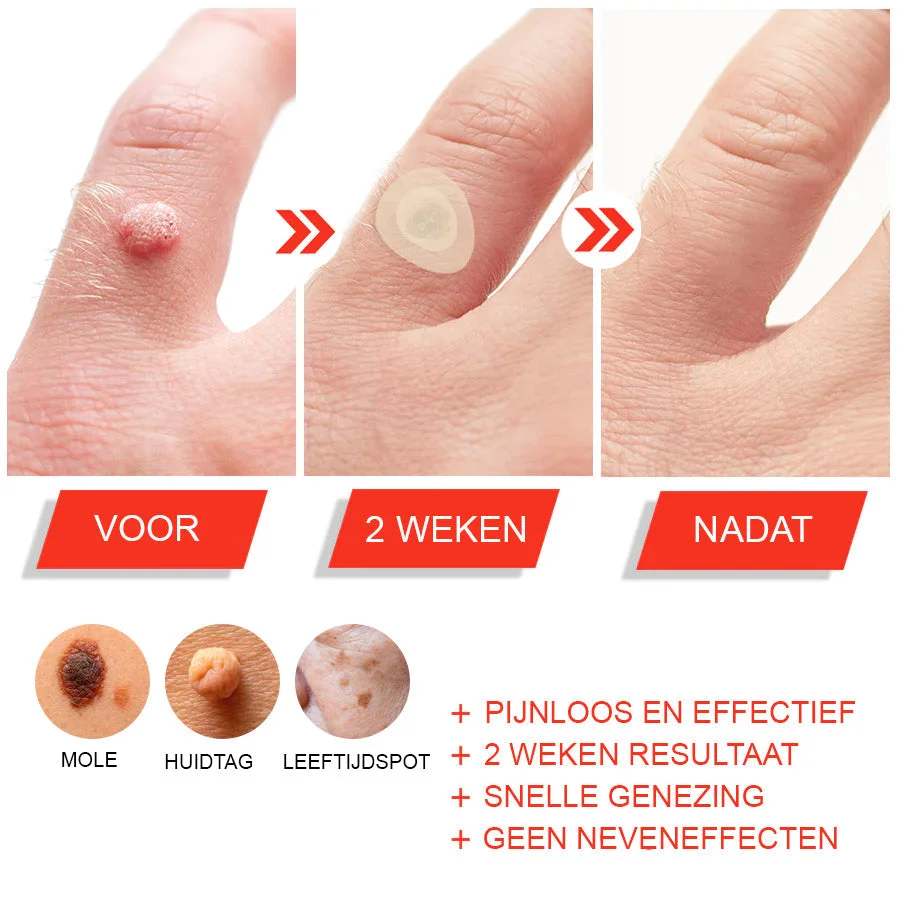 Nurbini™ Micro Darts Tagless Patch